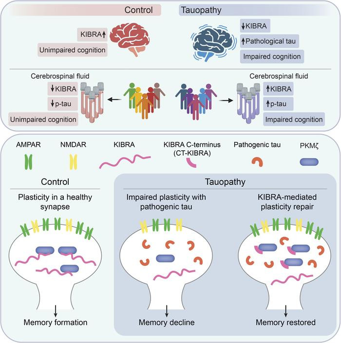 A patogén tau fehérje felhalmozódása az agyi szinapszisokban gátolja a szinaptikus plaszticitást, így pedig kulcsfontosságú az Alzheimer-kórhoz és más tauopathiákhoz kapcsolódó memóriavesztések létrejöttében. A kutatók rájöttek, hogy a KIBRA nevű fehérje kulcsfontosságú szerepet játszik a szinapszisok működésében, pótlása pedig a remények szerint helyreállíthatja az emlékezetet (forrás: The Journal of Clinical Investigation)