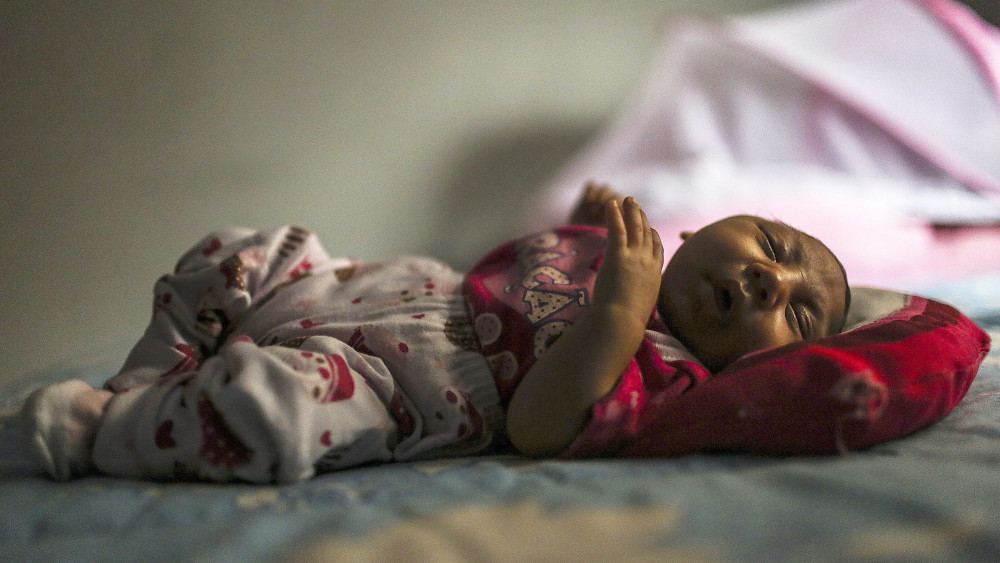 Rio de Janeiro, 2016. február 12.Egy kóros kisfejűséggel született egy hónapos kislány, Manuelly Araujo da Cruz Rio de Janeiróban 2016. február 11-én. Az édesanya várandósságának harmadik hónapjában fertőződött meg a zikavírussal, és feltehetőleg ez idézte elő a csecsemőben a mikrokefáliát. (MTI/EPA/Antonio Lacerda)