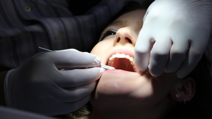 Fájdalmas drágulás: drasztikus áremelkedés a fogorvosoknál is