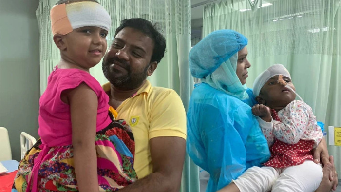 Most műtik a magyar orvosok a szétválasztott bangladesi ikerpár egyik tagját