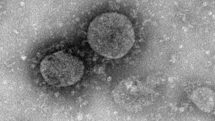 Durvul a koronavírus, de eléggé körbe van zárva