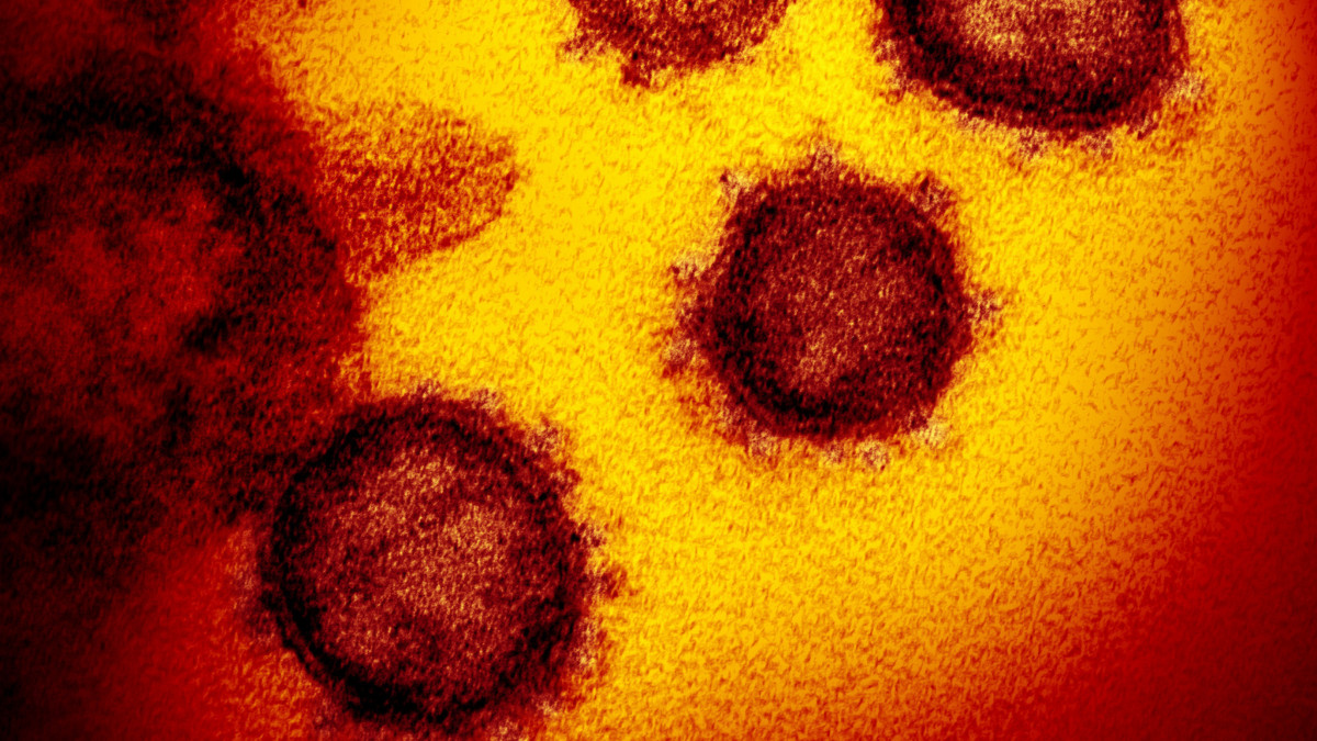 Az amerikai Allergiás és Fertőző Betegségek Országos Intézete (NIAID) által közreadott,  dátumozatlan elektronmikroszkópos kép a SARS-CoV-2 nevű koronavírusról. A 2019-nCoV néven is ismert vírus egy fertőző humán koronavírus, amely a COVID-19-nek nevezett, tüdőgyulladásos megbetegedést okozza. A mintát egy betegtől vették az Egyesült Államokban. A COVID-19-nek elnevezett újfajta koronavírus előidézte betegség halálos áldozatainak száma 1776-ra emelkedett Kínában, a legtöbben a járvány gócpontjában, Hupej tartomány székhelyén, Vuhanban hunytak el. A 2019 december közepe óta tomboló járvány fertőzöttjeinek száma 70 548-ra nőtt.