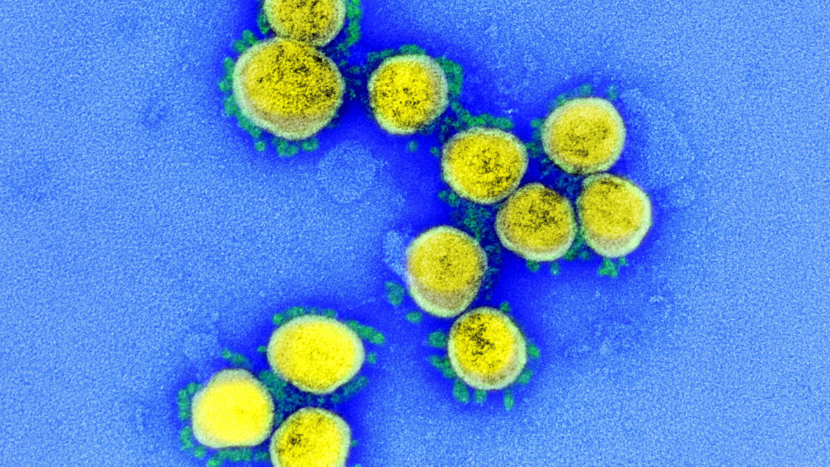 Az amerikai Allergiás és Fertőző Betegségek Országos Intézetében (NIAID) készült, és az amerikai Országos Egészségügyi Intézetek (NIH) által elérhetővé vált, dátumozatlan elektronmikroszkópos, utószínezett kép a SARS-CoV-2 nevű koronavírusról (sárga). A világjárványt okozó vírus mintáját egy betegtől vették.