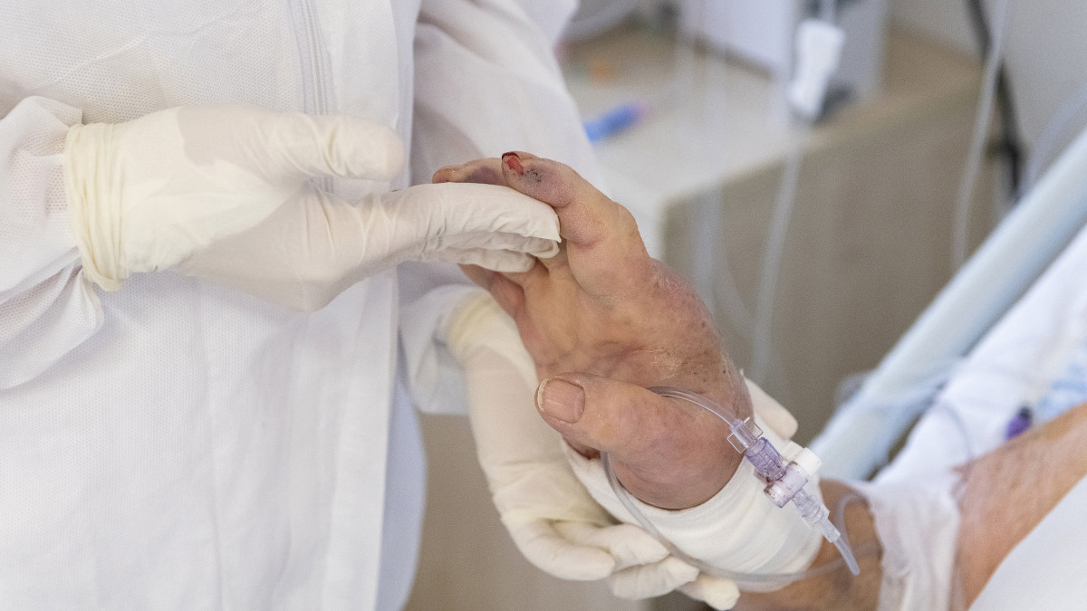 Gyógytornász nézi az egyik beteg kezét a Jósa András Oktatókórház COVID-intenzív osztályán Nyíregyházán 2020. november 25-én.