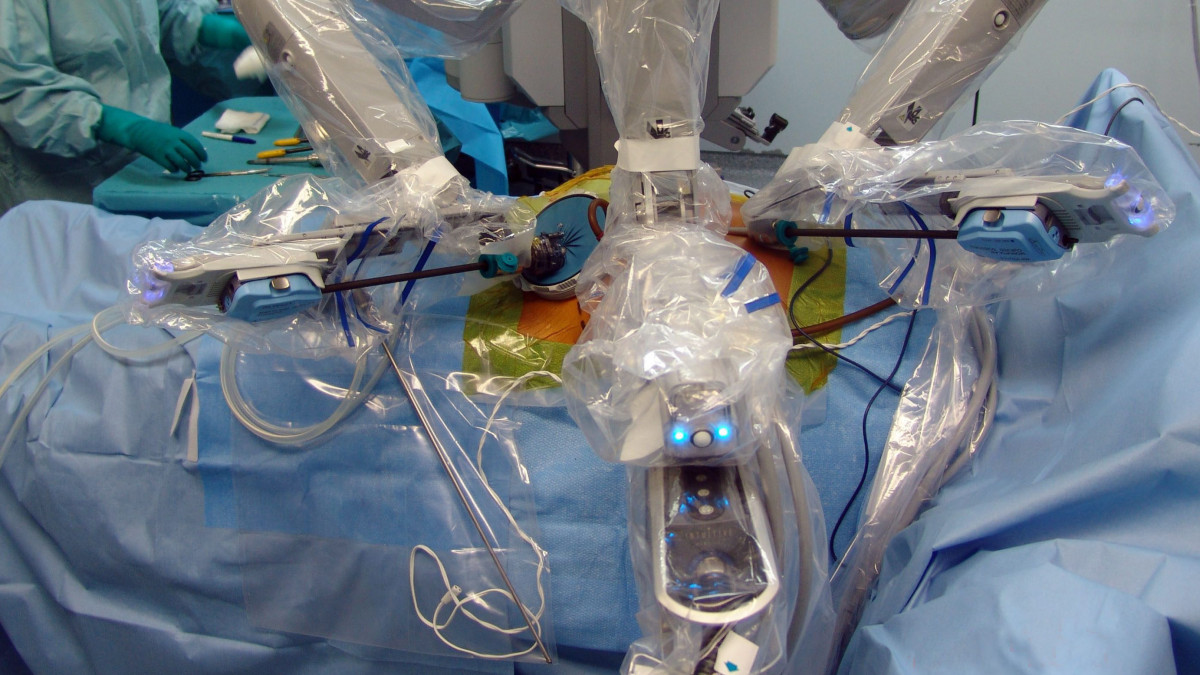 Pisa, 2010. július 19.Első alkalommal végeznek távirányítású robot segítségével veseátültetést Olaszországban, a pisai Egyetemi Kórházban 2010. július 3-án. Ugo Boggi, a sebészeti és transzplantációs osztály igazgatója 2010. július 19-án bejelentette, hogy az élődonoros vesetranszplantáció sikeres volt. A Da Vinci robottechnikai rendszer segítségével egy 57 éves anya egyik veséjét ültették be 37 éves lánya szervezetébe. (MTI/EPA)