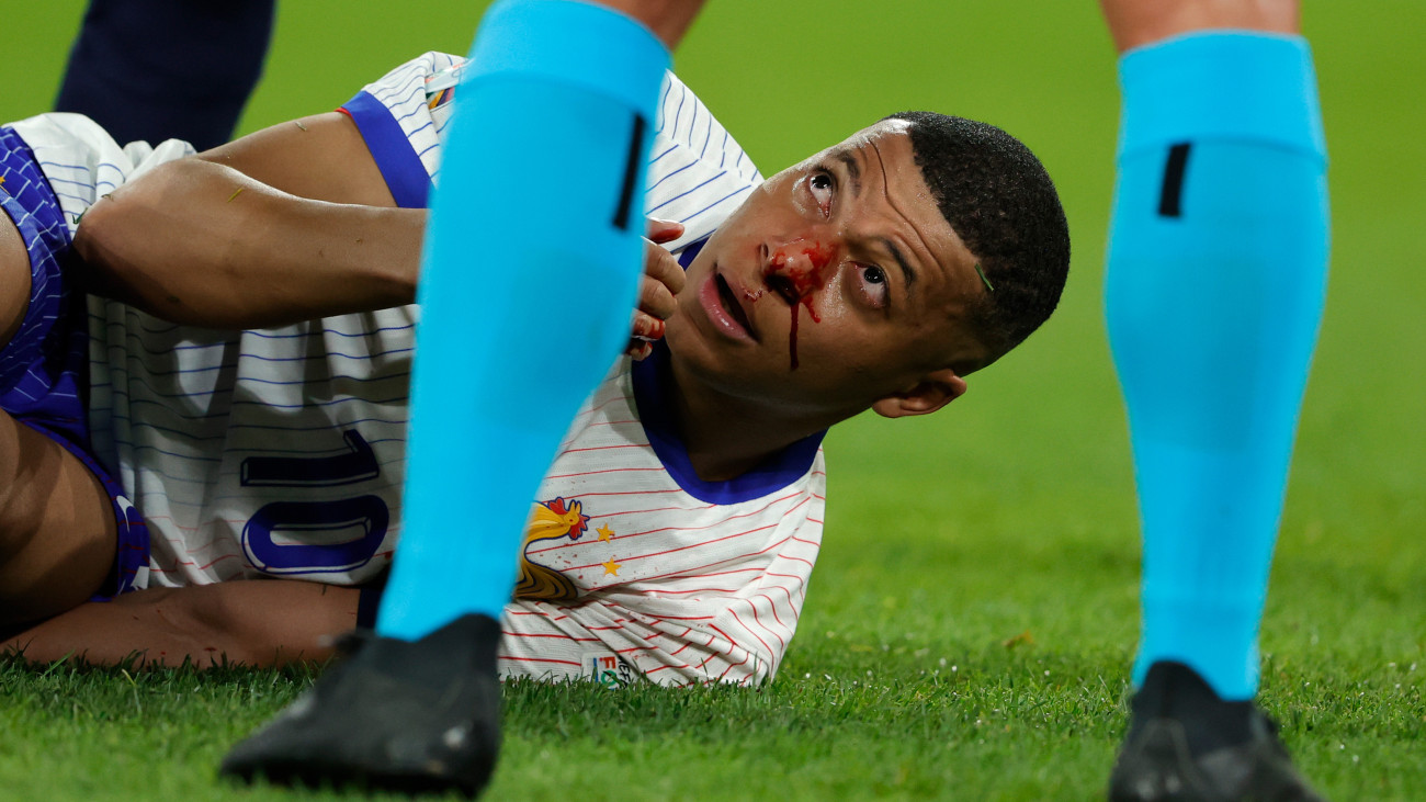 DUSSELDORF, GERMANY - JUNE 17: Kylian Mbappe of France Injured his head during the  EURO match between Austria  v France at the Merkur Spiel Arena on June 17, 2024 in Dusseldorf Germany (Photo by Rico Brouwer/Soccrates/Getty Images)