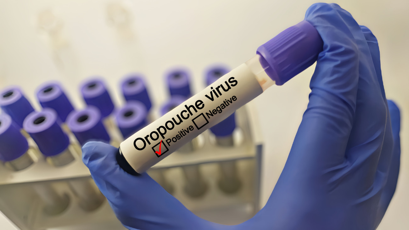 Doctor with Oropouche virus positive blood sample. Doctor with Oropouche virus positive blood sample. Medical laboratory