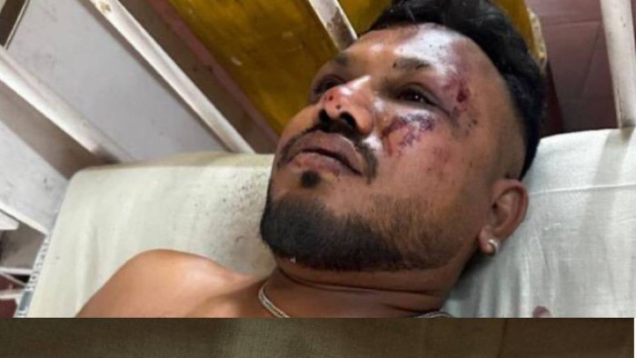 Túlélte egy ember az indiai repülőszerencsétlenséget - videó