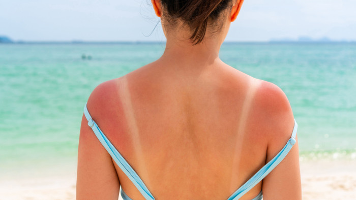 Fényérzékenységet, sőt kiszáradást is okozhatnak egyes gyógyszerek