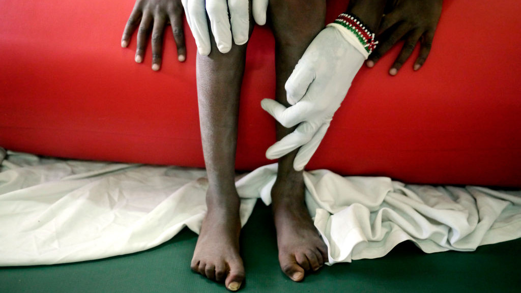 Mozgássérült afrikai gyerek