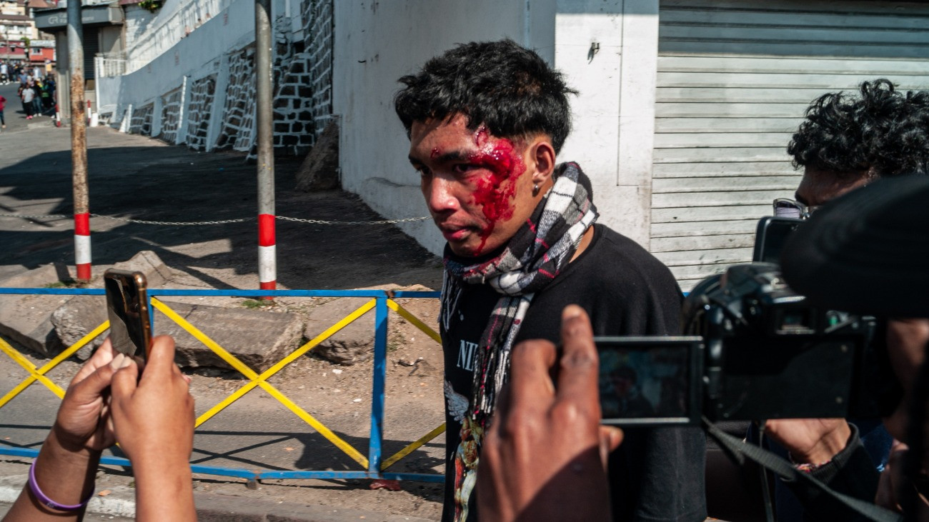 2025. szeptember 25-i kép egy sebesült fiatalról az ivóvíz- és áramszolgáltatás akadozása miatt kirobbant tüntetések egyikén a madagaszkári fõvárosban, Antananarivóban. Andry Rajoelina madagaszkári elnök szeptember 29-én elrendelte az afrikai szigetország kormányának felmentését azt követõen, hogy a zavargássá fajult tüntetéseken az ENSZ emberi jogi fõbiztossága szerint 22-en meghaltak.