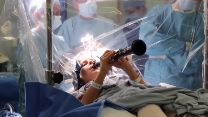 Lyukat fúrtak a nő agyába, miközben ő klarinétozott – videó