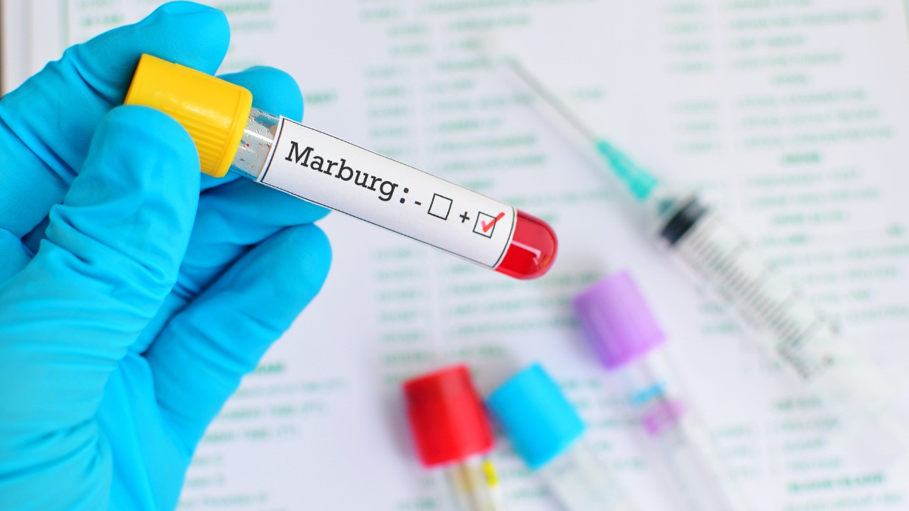 Marburg-vírus teszt, pozitív vérmintacső.