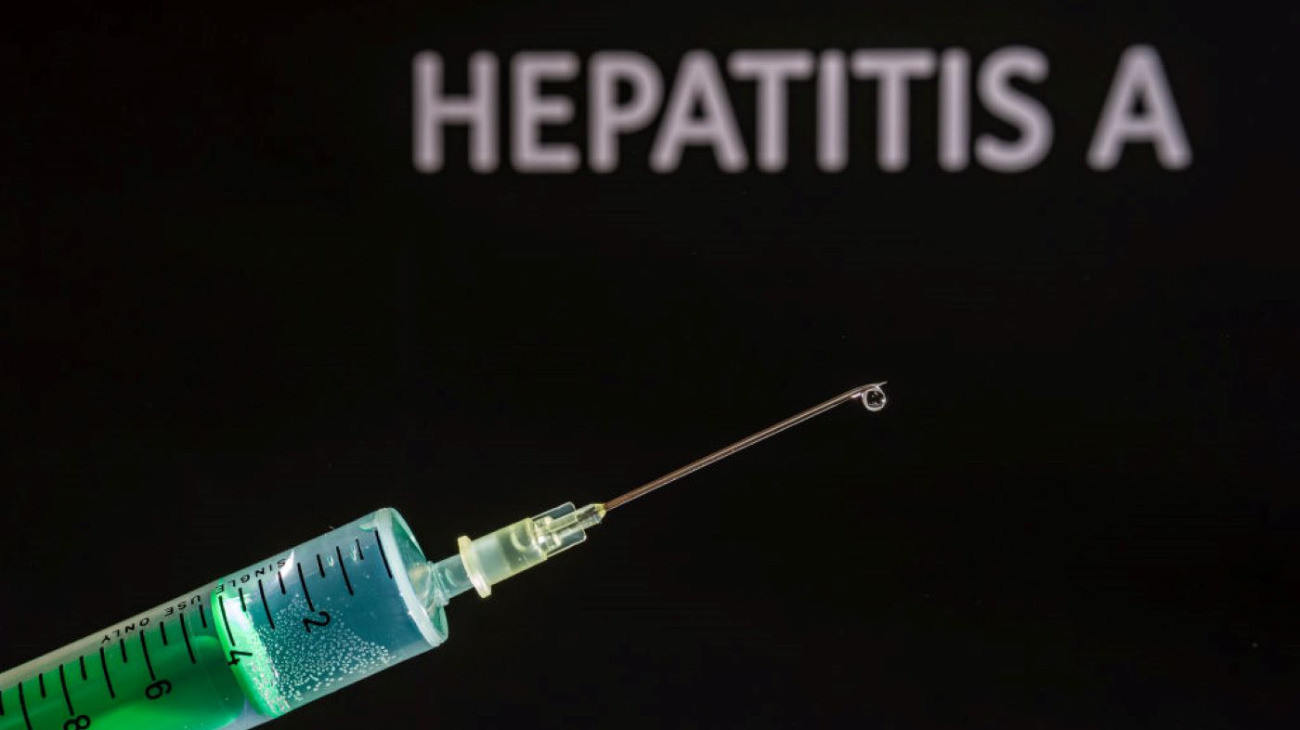 Fertőző májgyulladás, hepatitisz A.