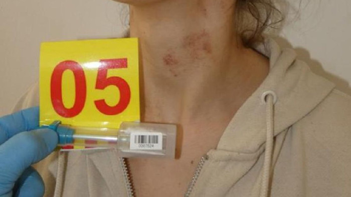 Horror Dunaföldváron: megkötözték a nőt, de az lerágta a köteléket és elmenekült a babájával