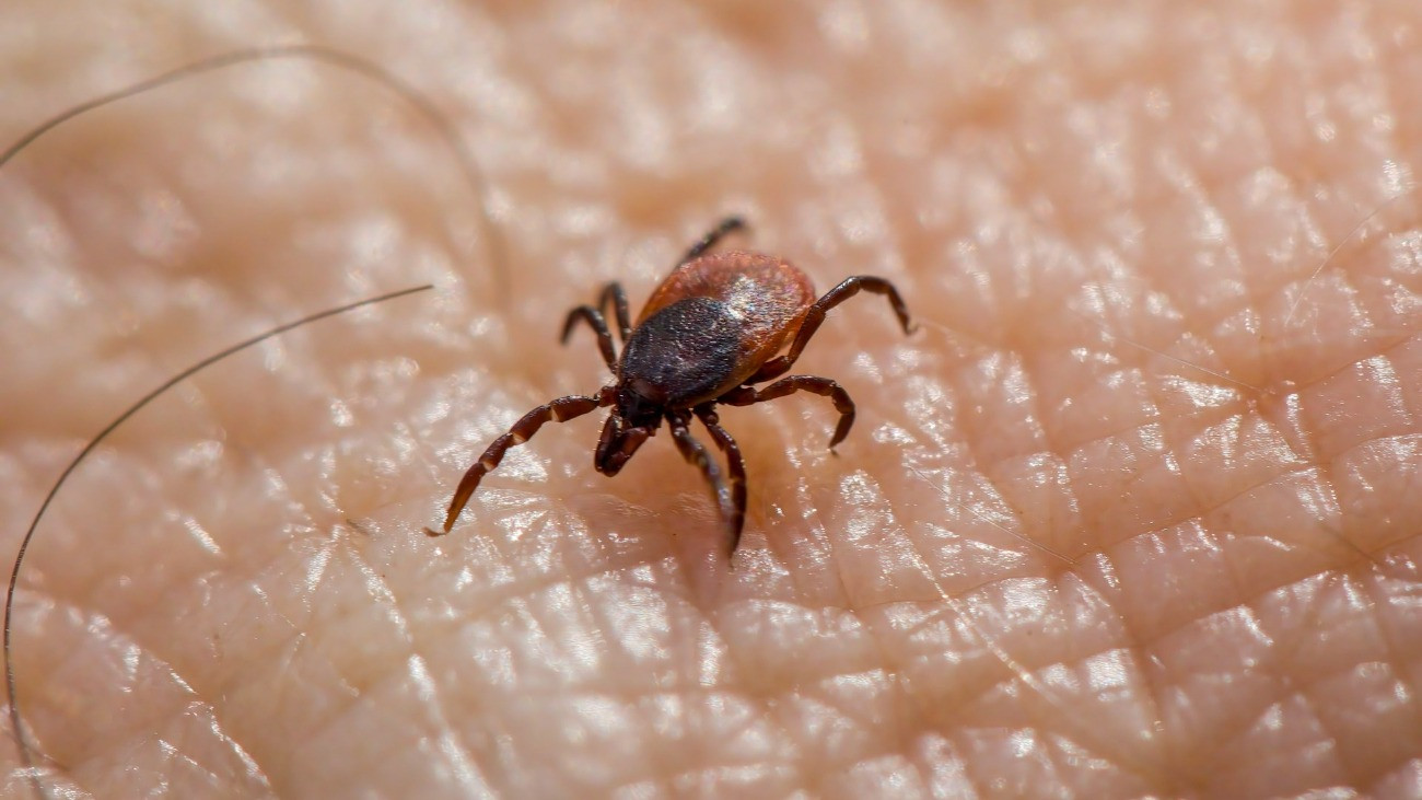 Egy kullancs mászik egy ember bőrén.