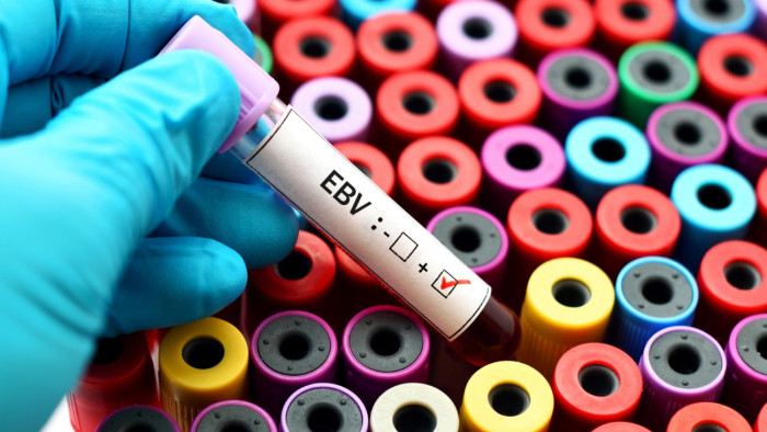 A felnőttek 95 százaléka hordozza a veszélyes vírust, most ellenszerre bukkantak